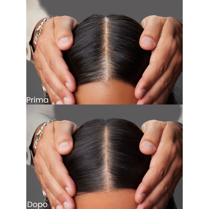 Joico Scalp Vitality Replenishing Essence prima e dopo trattamento 