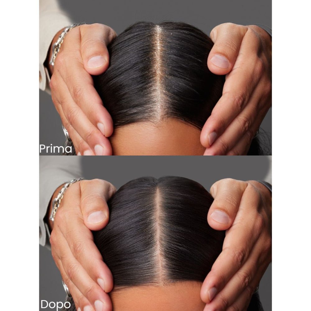 Joico Scalp Vitality Exfoliating Foaming Scrub prima e dopo trattamanto scrub