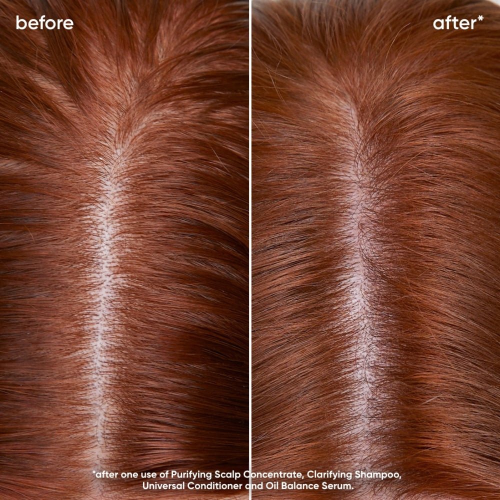 Biolage Scalp Sync Oil Balancing Serum cuoio capelluto grasso 50ml - Planethair 