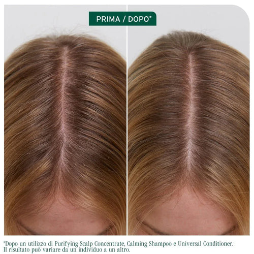 Biolage Scalp Sync Clarifying Shampoo cuio capelluto grasso 400ml - Planethair