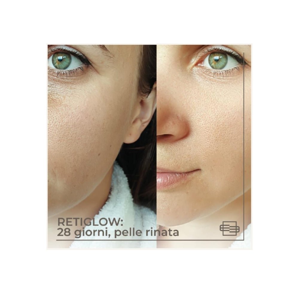 RetiGlow Crema Rivitalizzante risultati dopo 28 giorni di utilizzo