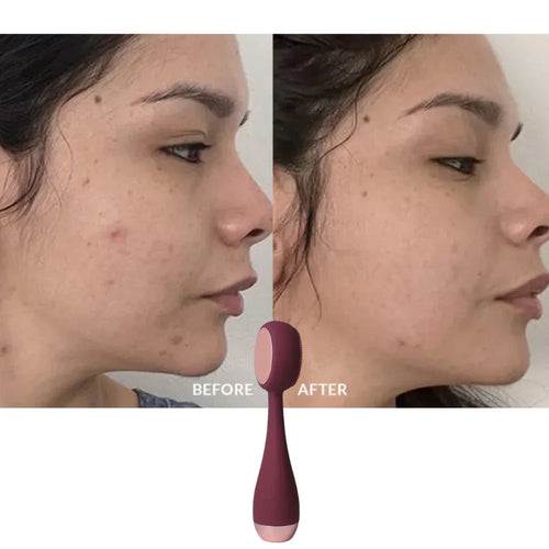 Dettaglio testina in silicone antibatterico PMD Beauty Clean Pro e risultati visibili