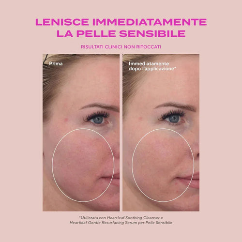Murad Heartleaf Calming Cream applicazione – idratante lenitivo con estratto di heartleaf

