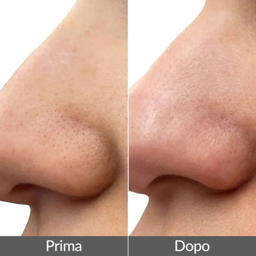 PMD Beauty Wave Pro in uso — modalità Extract pulizia profonda