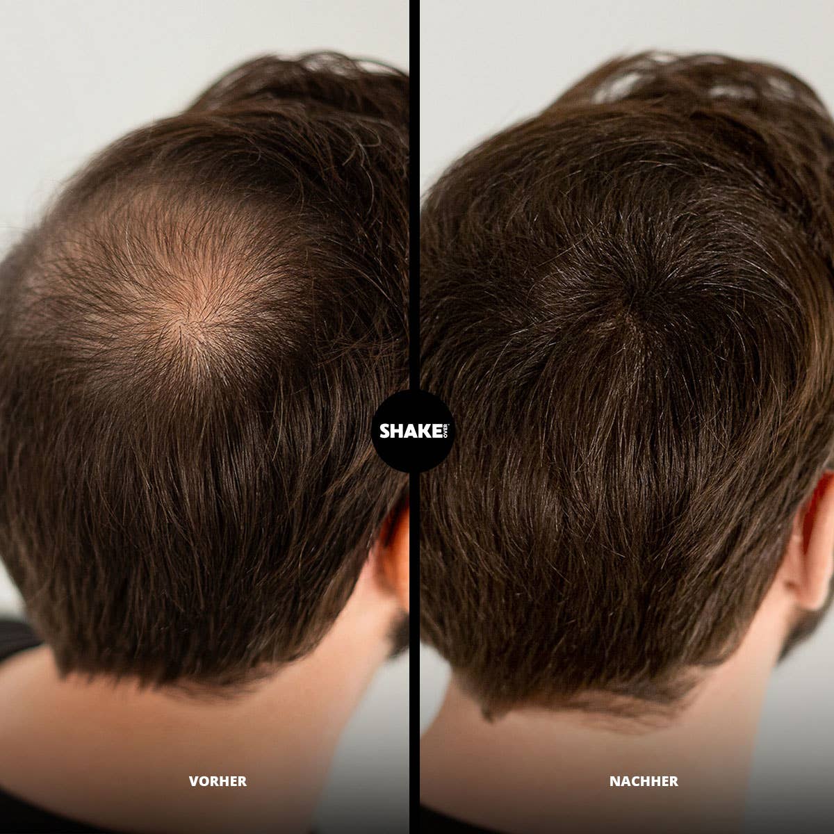 SHAKE OVER Fibre per Capelli con Zinco