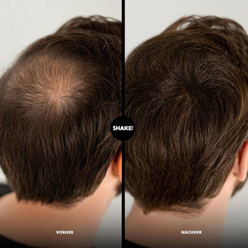 SHAKE OVER Fibre per Capelli con Zinco