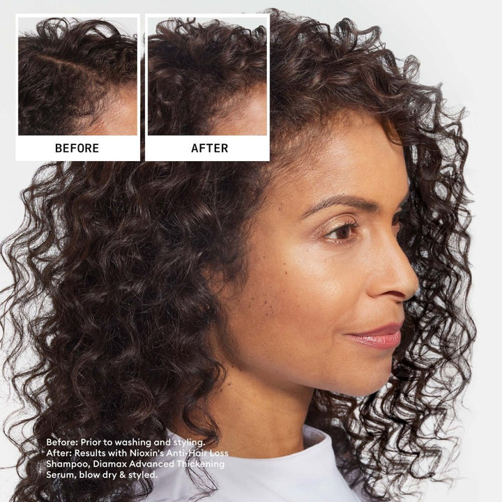 Nioxin Anti Hair Loss Shampoo anticaduta capelli - Planethair 