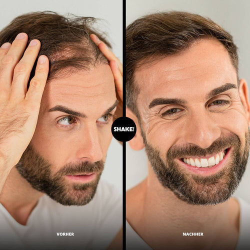 SHAKE OVER Fibre per Capelli con Zinco