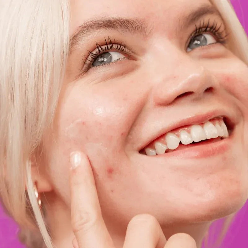 Dermalogica Breakout Clearing Booster Siero Viso Anti Imperfezioni 30ml - Planethair