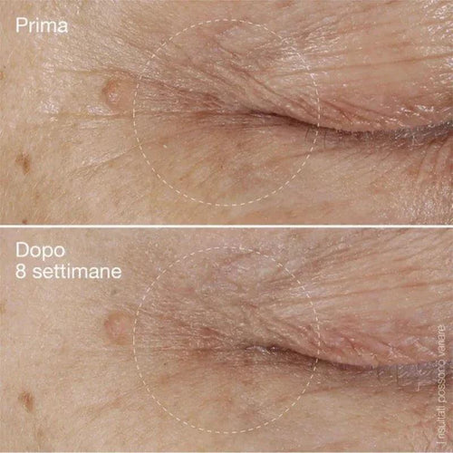 Dermalogica BioLumin-C Eye Serum Trattamento Contorno Occhi 15ml - Planethair