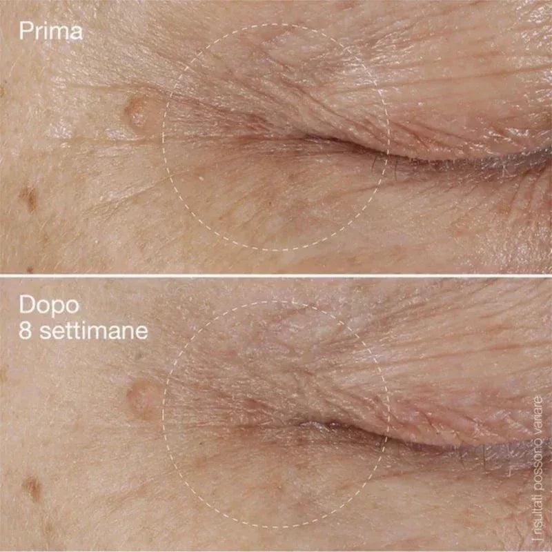 Dermalogica BioLumin-C Eye Serum Trattamento Contorno Occhi 15ml - Planethair