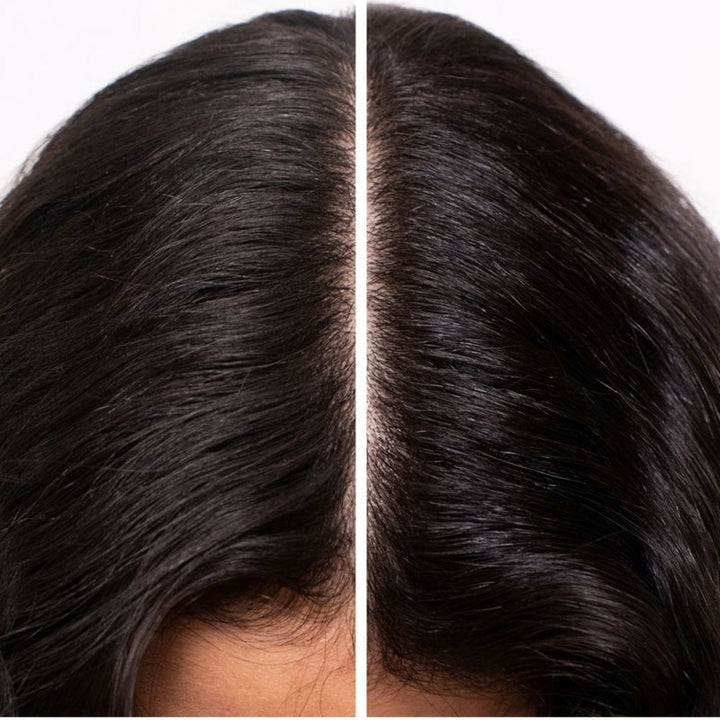 Shu Uemura Essence Absolue Scalp Oil Concentrate cuoio capelluto secco 50ml - Planethair 