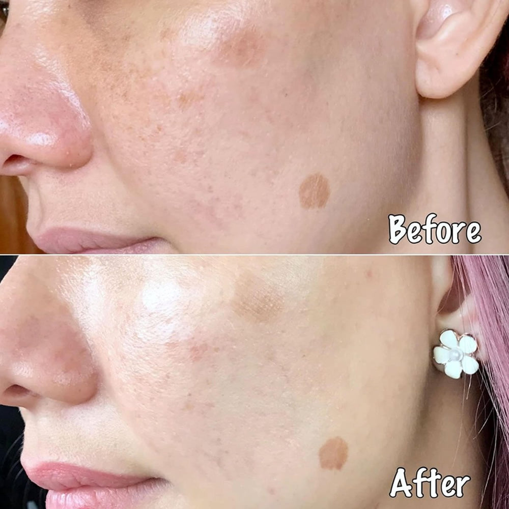 Murad Night Fix Enzyme Treatment crema viso notte 30ml - Planethair 