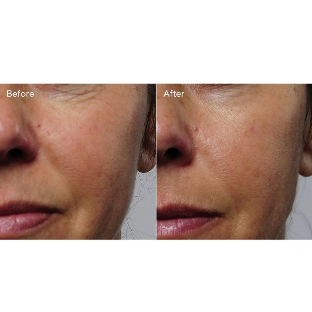 Murad Rapid Collagen Infusion siero collagene 30ml - Planethair 