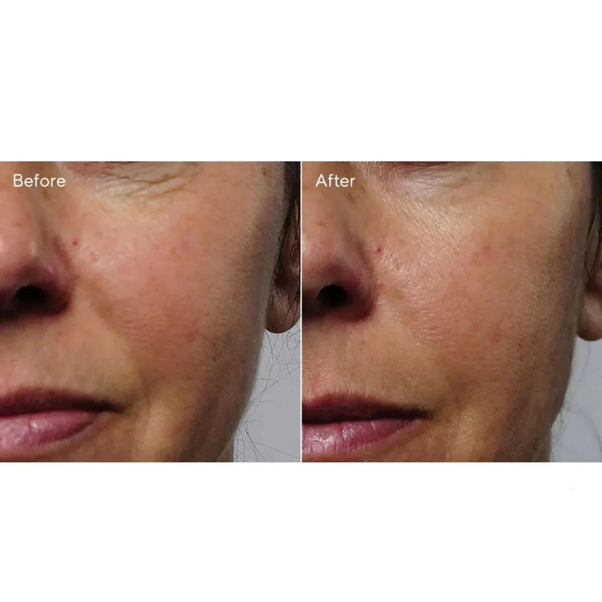 Murad Rapid Collagen Infusion siero collagene 30ml - Planethair