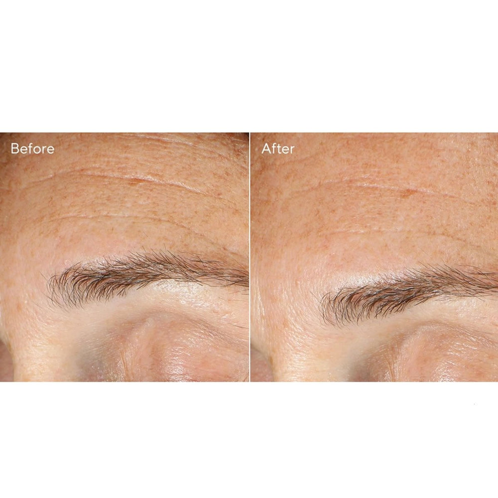 Murad Replenishing Multi-Acid Peeling viso 100ml - Planethair 