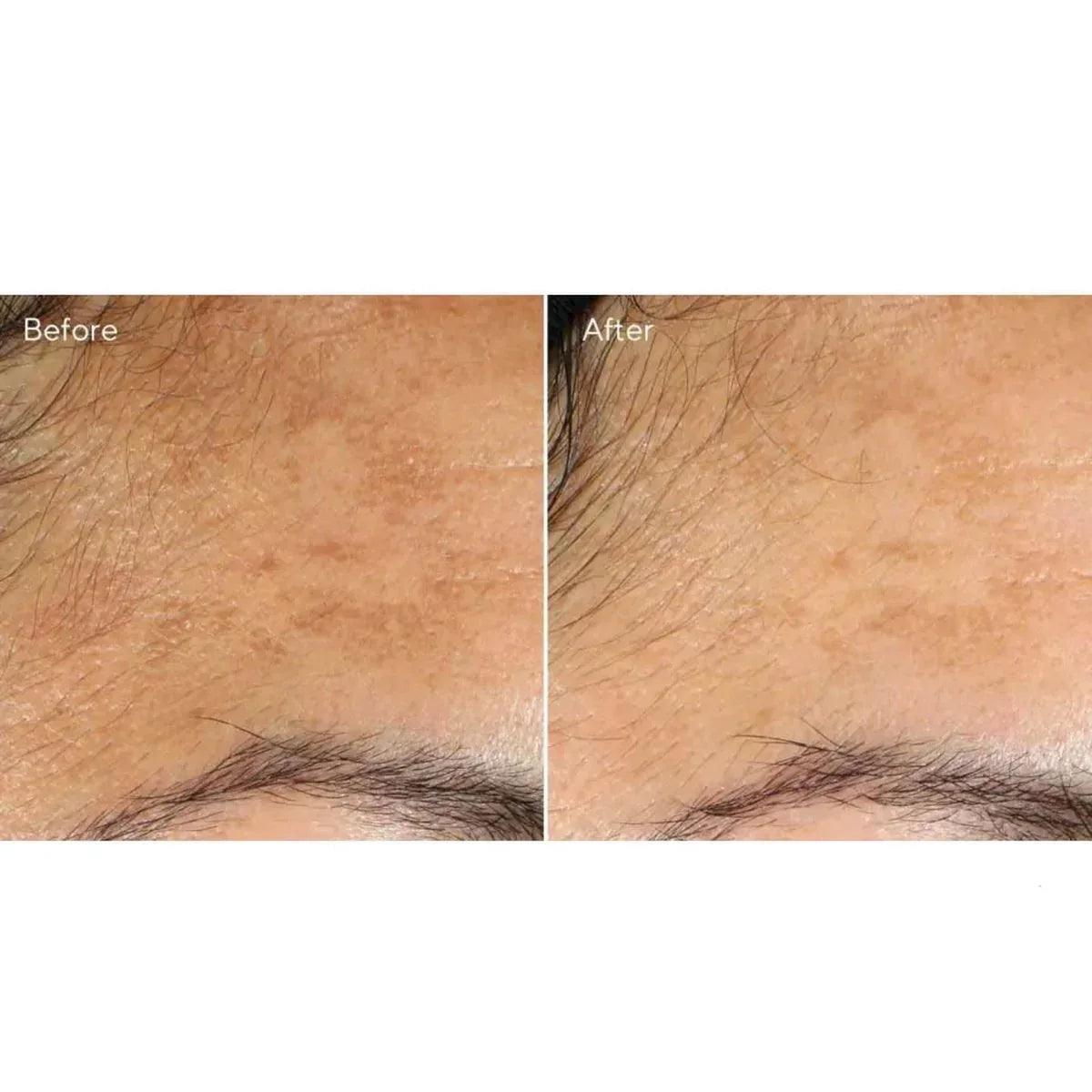 Murad Vita-C Glicolic Brightening Siero vitamina C illuminante 30ml - Planethair