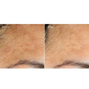 Murad Vita-C Glicolic Brightening Siero vitamina C illuminante 30ml - Planethair