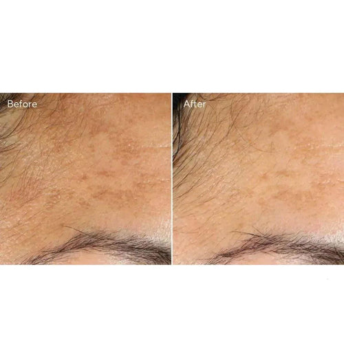 Murad Vita-C Glicolic Brightening Siero vitamina C illuminante 30ml - Planethair