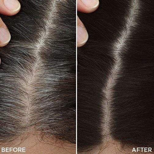 Toppik Root Touch Up Spray Castano Scuro Ritocco Ricrescita 40gr - Planethair 